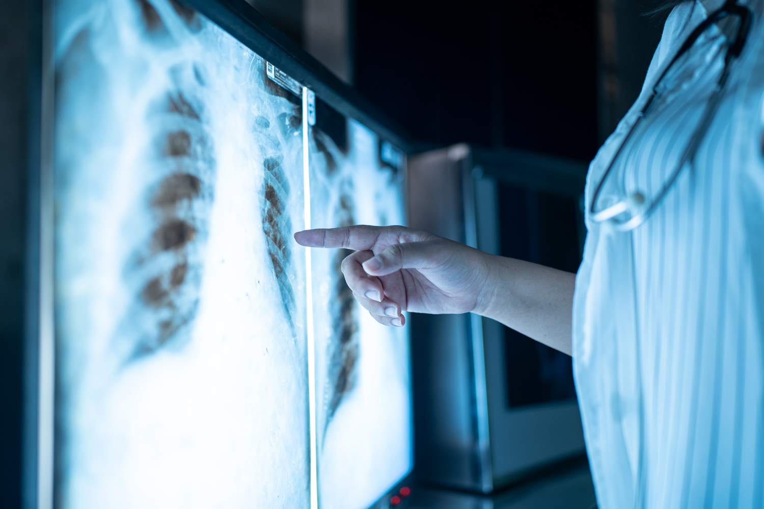 psifiako aktinologiko