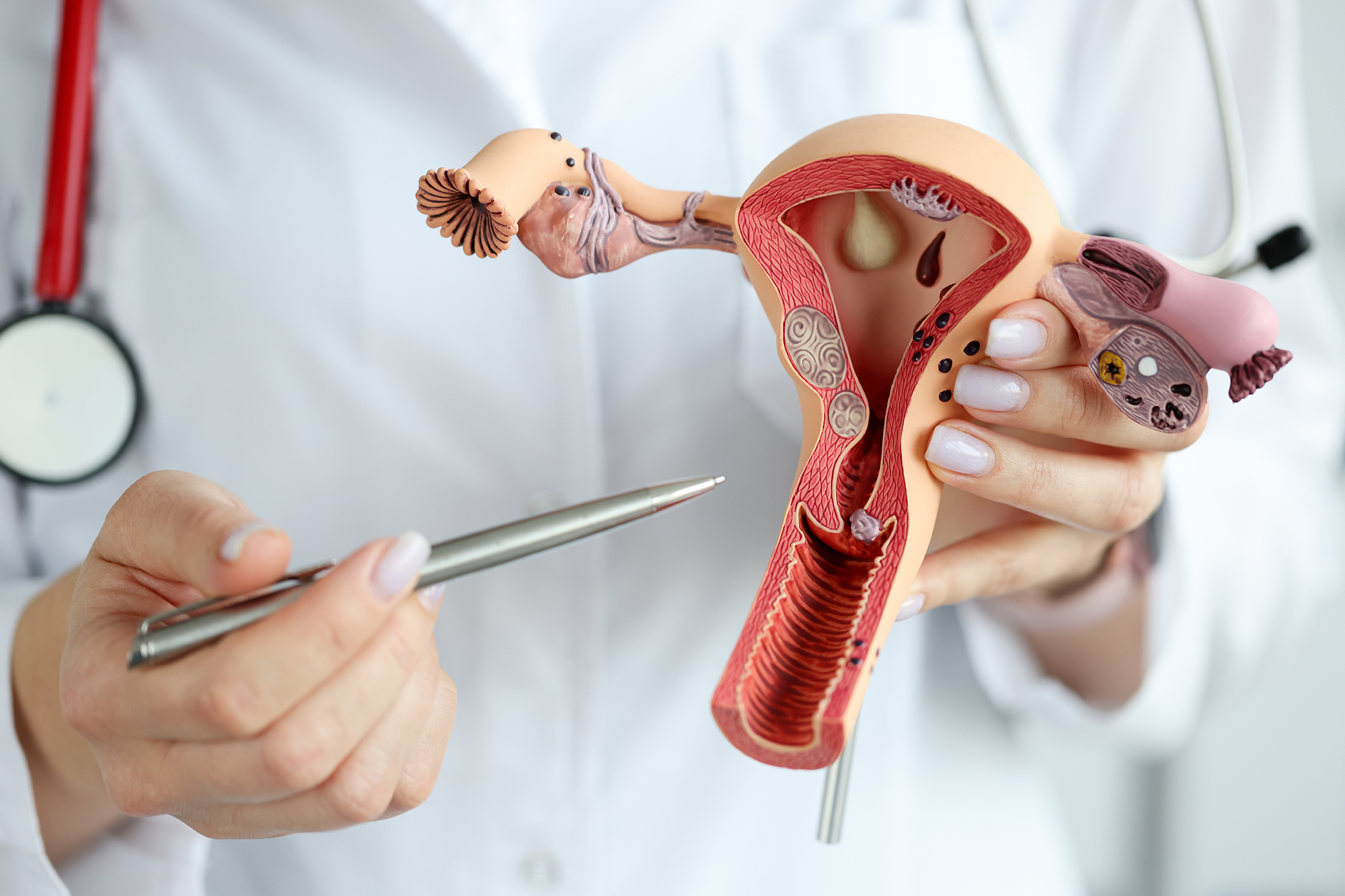 doctor-gynecologist-showing-pen-plastic-model-uterus-ovaries-closeup