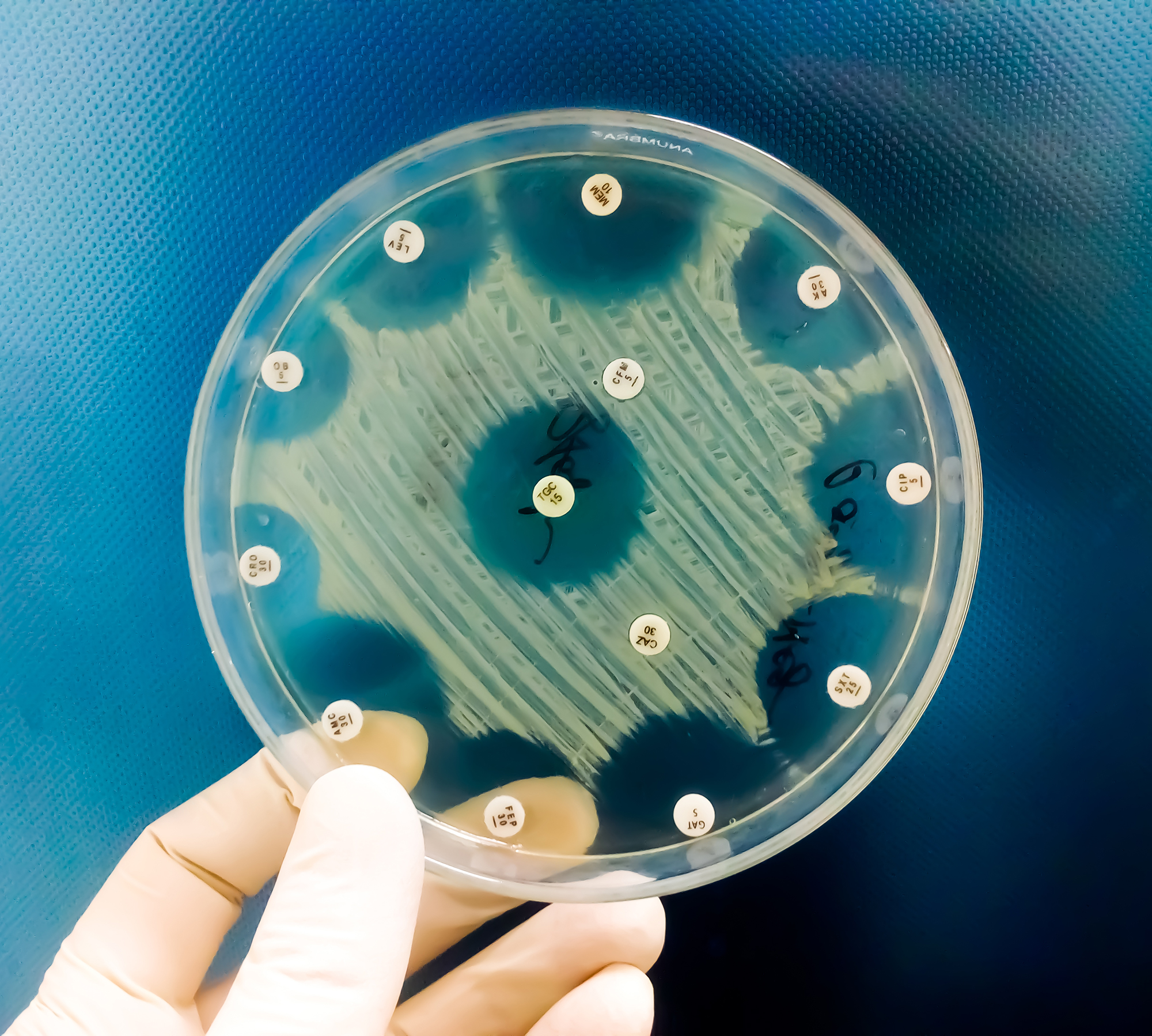 hand-holding-culture-plate-bacterial-growth-showing-antibiotic-sensitivity-their-colony