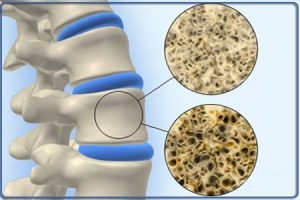 μοστικ-300x200